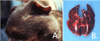 Bordetella Pneumonia