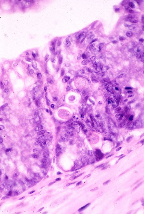 Eimeria falciformis gametocytes in the colonic mucosa.
