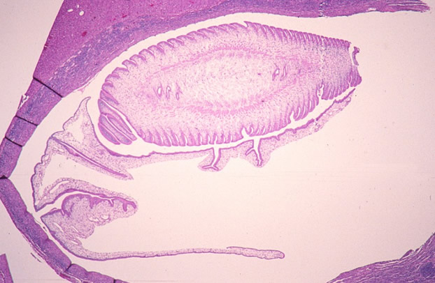 Cross-section of cysticercus in liver.