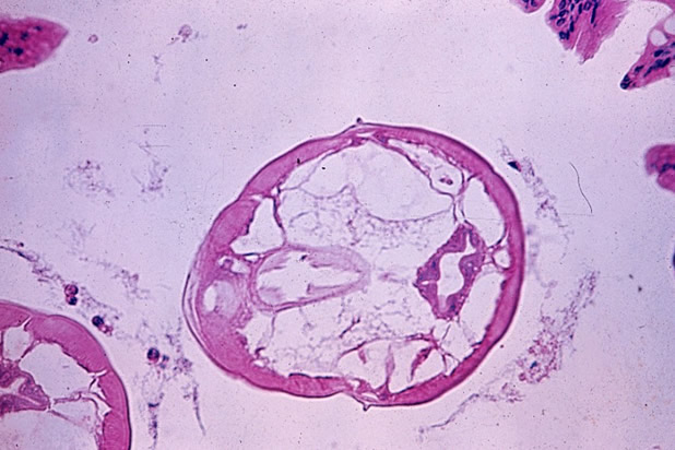 Cross-section of Syphacia sp.