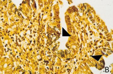 Tyzzer’s Disease – College of Veterinary Medicine