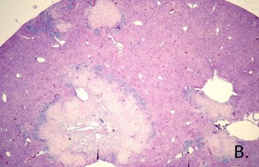 Tyzzer’s Disease – College of Veterinary Medicine