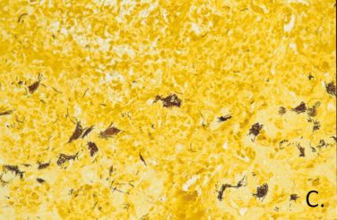 Tyzzer’s Disease – College of Veterinary Medicine