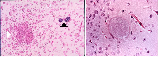 Encephalitozoonosis