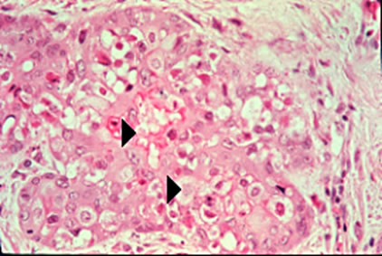 Myxomatosis Virus Diagram