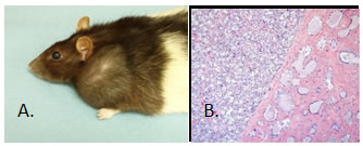 Mammary Fibroadenoma