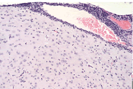 Lymphocytic Choriomeningitis Virus (LCMV)