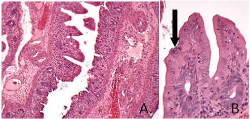 Enteric Coronavirus