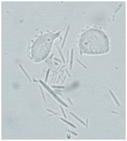 Trichomonads