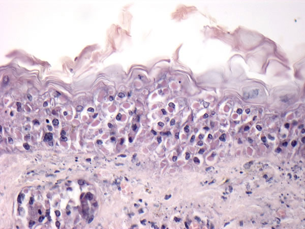 Ectromelia Virus (Mousepox)