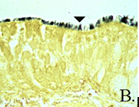 Filobacterium rodentium (formerly CAR Bacillus)