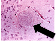Microsporidian parasites