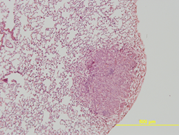 Alveolar/Bronchiolar Adenoma