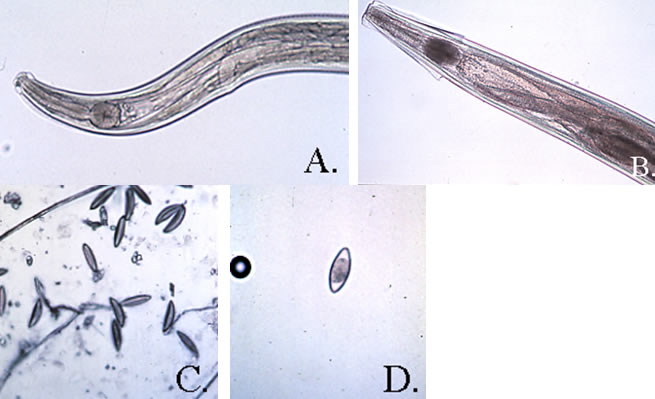 Pinworms