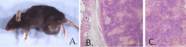 Mammary Adenocarcinoma