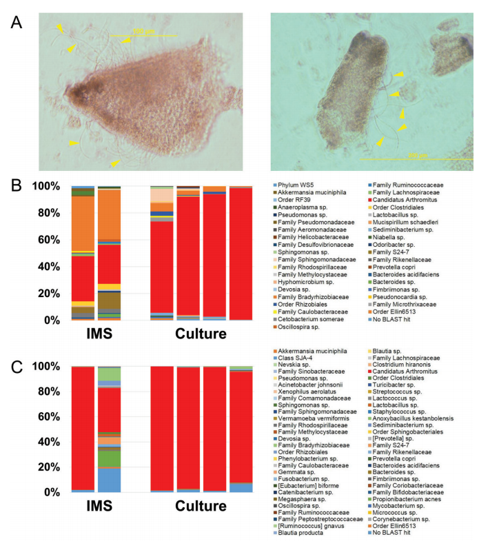 Ericsson, A.C., Turner, G., Montoya, L., Wolfe, A., Meeker, S., Hsu, C., Maggio-Price, L., and C.L. Franklin. (2015) Isolation of segmented filamentous bacteria from a complex gut microbiota. BioTechniques, 59(2): 94-98. PMID: 26260088 (PMCID in process)
See full study